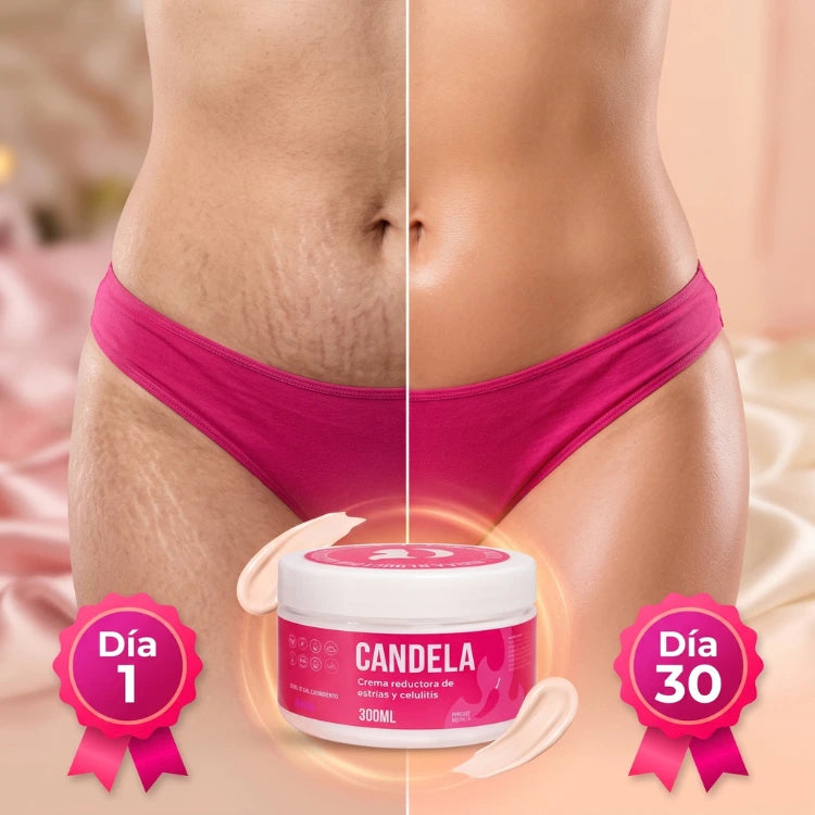 CANDELA - Crema reductora de estrías y celulitis